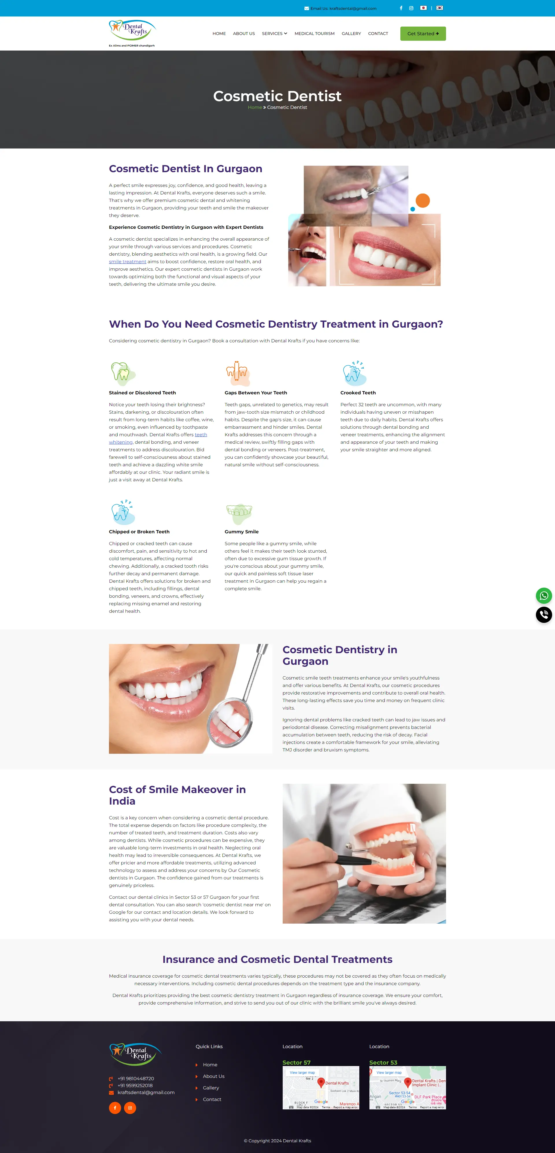 cosmodontistdental-root-canal-treatment